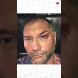 Dave Bautista has had some pretty gnarly injuries  #menshealth