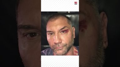 Dave Bautista has had some pretty gnarly injuries  #menshealth